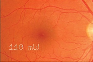 Array LaserLink Heads Up Display